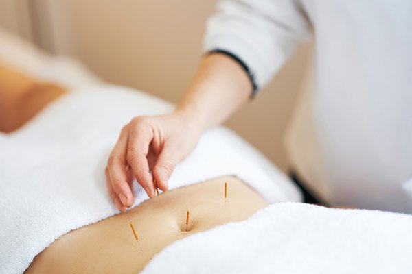 Quels sont les bienfaits de l'acupuncture pour réduire les nausées matinales durant la grossesse?